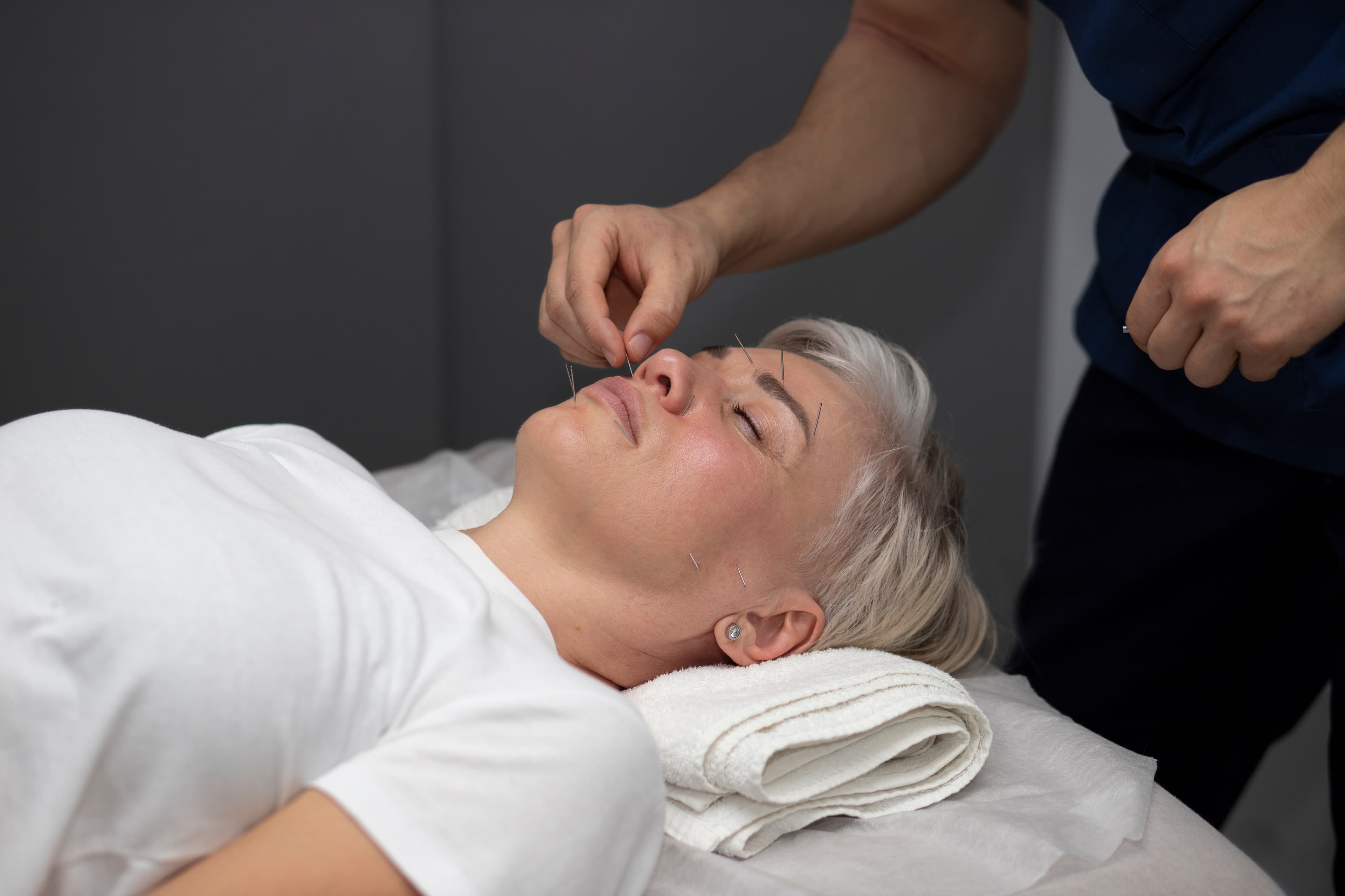Acupuncture & Moxibustion